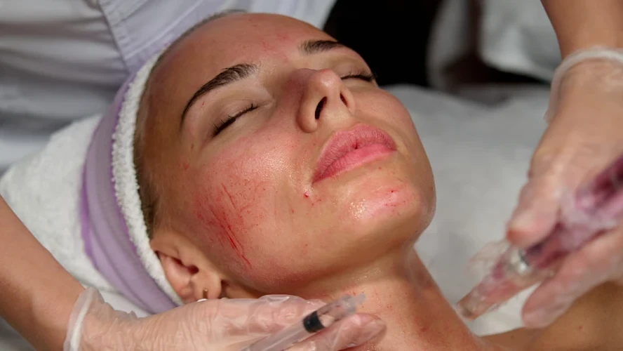 Dealing with Extreme Swelling After Microneedling