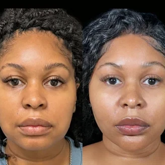 Permanent Threads miami