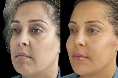 Permanent Threads miami