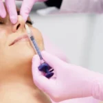 How Long Does Nose Filler Last