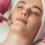Is Microneedling Permanent Lasting Skin Benefits