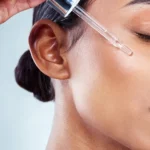 Is Your Skin Experiencing a Retinol Purge