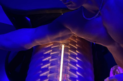 Body Roll Treatment Miami 03