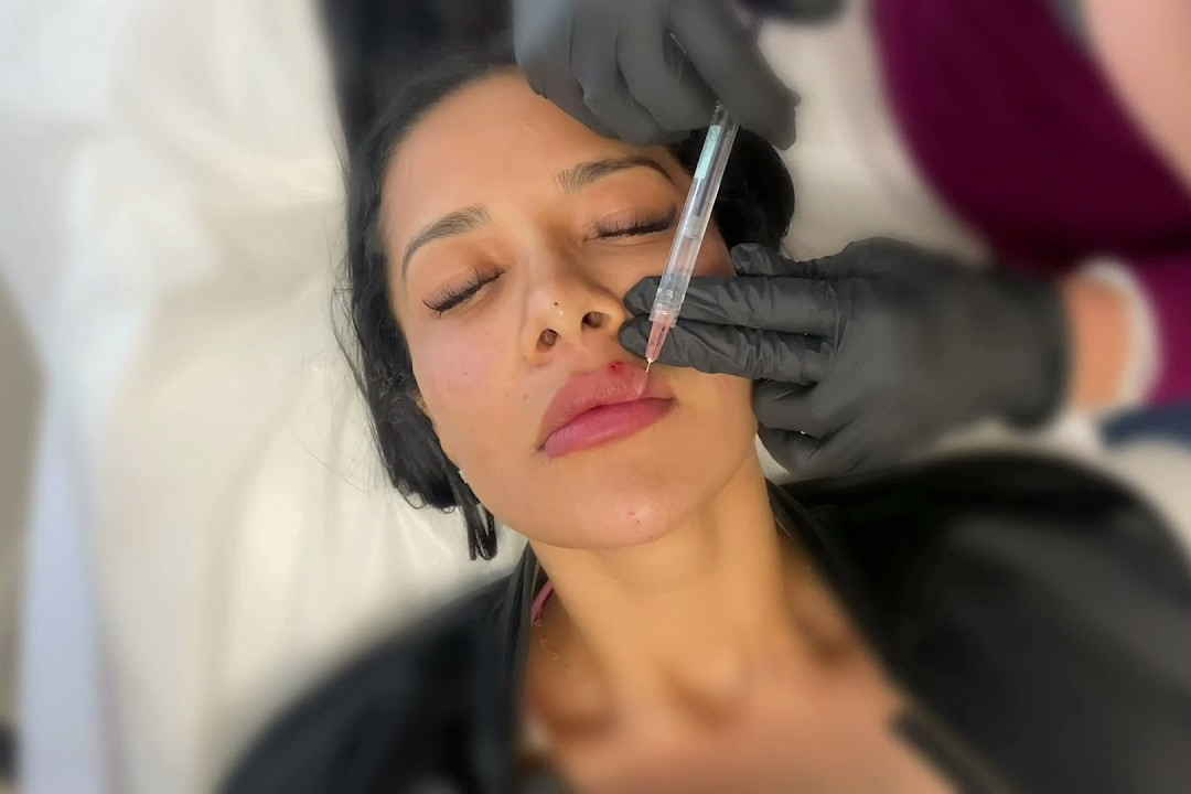 facial balancing making the switch uai